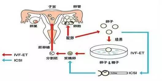 高龄女性试管婴儿成功率影响因素分析